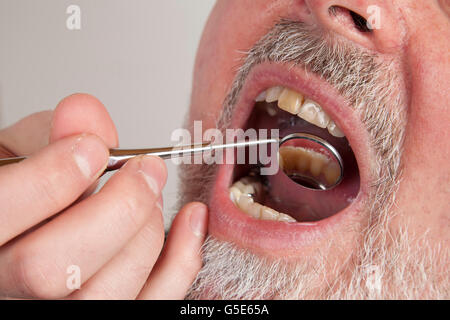 Paziente, 59, durante un check-up presso il dentista Foto Stock