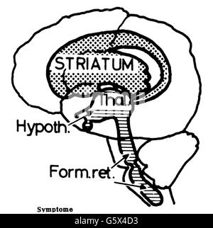 Medicina,farmacia,immagine schematica degli effetti dei farmaci contro i problemi psicosomatici che possono causare sintomi simili al morbo di Parkinson,disegno,XX secolo,XX secolo,grafica,schema,schema,schemi,cervello,cervello,farmaco,farmaco,farmaci,pillola,compresse,compresse,stato di ansia,stato di ansia,stato di stress,stati di stress,effetti collaterali psicotici,effetti collaterali aggiuntivi,effetti collaterali-cancellativi,effetti collaterali-non-disponibili,effetti collaterali-farmacologici,effetti collaterali-farmacologici,effetti collaterali,effetti collaterali-disponibili,effetti collaterali-farmacologici,effetti collaterali-farmacologici,effetti collaterali,effetti collaterali-non-disponibili Foto Stock