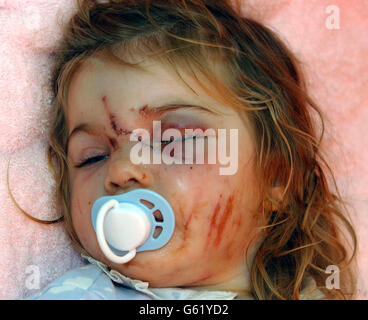 Jade Wardle attacco del cane Foto Stock