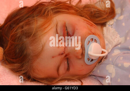 Jade Wardle attacco del cane Foto Stock