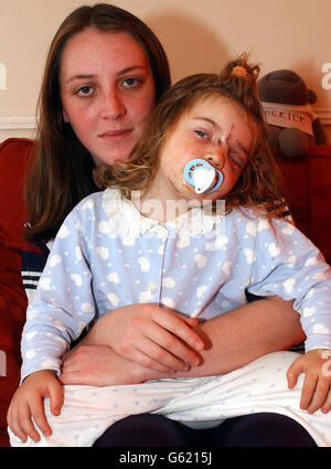 Jade Wardle attacco del cane Foto Stock