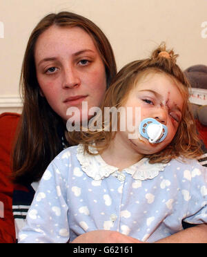 Jade Wardle attacco del cane Foto Stock