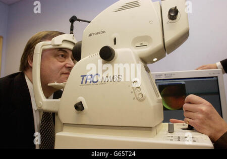 Il vice primo ministro John Prescott ha controllato la sua retina su un sistema di screening della retinopatia presso il St. Thomas' Hospital nel centro di Londra. La macchina scatta un'immagine della retina per aiutare a rilevare eventuali anomalie che spesso si verificano con i malati di diabete. * il sig. Prescott, egli stesso diabetico, e il segretario alla salute Alan Milburn, erano all'ospedale per contribuire a lanciare il quadro del Servizio Nazionale per il diabete e l'Endocrinologia. Foto Stock