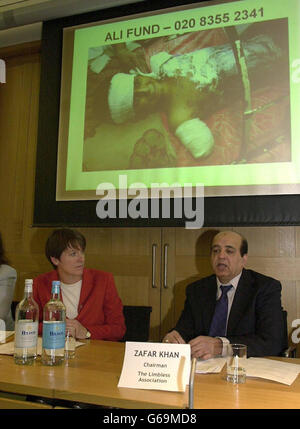 Caroline Spelman, deputato Shadow per lo sviluppo internazionale, e Zafar Khan, presidente della Limbless Association, lanciano il Fondo Ali a Westminster. * il fondo, che prende il nome da Ali Ismail Abbas (sullo schermo), 12 anni, che ha perso entrambe le armi in un bombardamento a Baghdad, è per aiutare i bambini feriti nel conflitto iracheno. Foto Stock