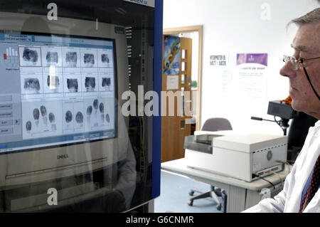 Assistente amministrativo, prende le impronte delle dita per le 'ARC' (carte di registrazione dell'asilo) che sono in corso di elaborazione, a Croydon. * il segretario di casa David Blunkett si aspettava di grandinare le cifre di asilo come un segno che era sulla strada per soddisfare l'impegno di Tony Blair di dimezzare i numeri di domanda entro settembre.il Home Office stava pubblicando il numero di nuovi arrivi in cerca di asilo per i primi tre mesi di questo anno. Foto Stock