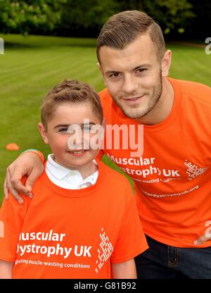 Jack Wilshere Distrofia Muscolare Foto Stock