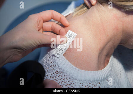 Il dermatologo Melanoma di misurazione durante il cancro alla pelle il test Foto Stock