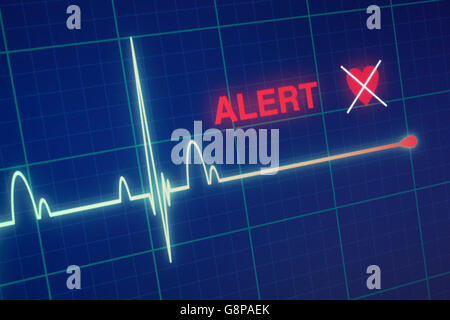 Battiti cardiaci cardiogram sul monitor Foto Stock