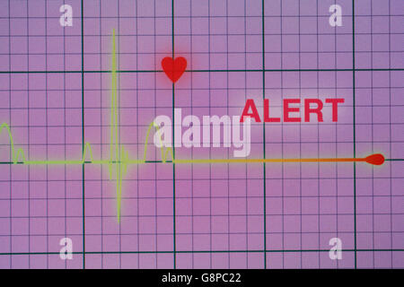 Battiti cardiaci cardiogram sul monitor Foto Stock