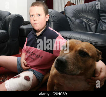 Adam Patrick Boyd, 10 anni, da West Denton a Newcastle, con il suo terrier toro Staffordshire Tess (NON il cane che lo ha attaccato), dopo che è stato attaccato da un cane di tipo Staffordshire bull terrier. Foto Stock