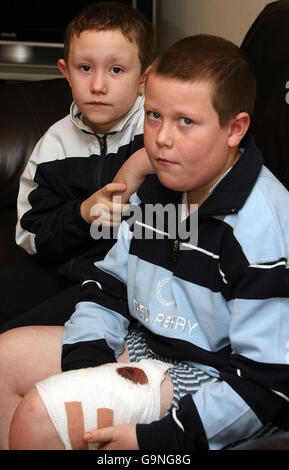 Newcastle attacco del cane Foto Stock