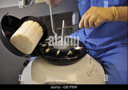 Lyndon Miles, responsabile di Embriologia e Andrologia per IVF Wales presso l'University Hospital of Wales di Cardiff, colloca un embrione congelato con il nuovo processo di vetrificazione in una camera di stoccaggio a lungo termine. Foto Stock