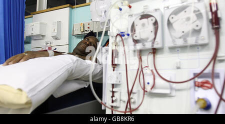 Il paziente renale Noel Ashmead riceve un trattamento su una macchina per dialisi presso il Guys Hospital di Londra. Foto Stock