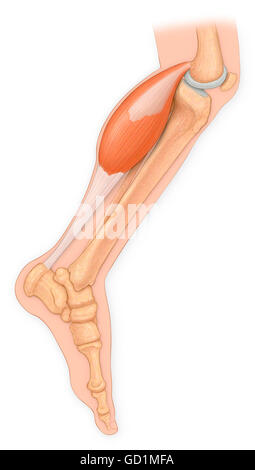 Vista medico delle ossa della gamba con riparazione del tendine di Achille e il muscolo gastrocnemio Foto Stock