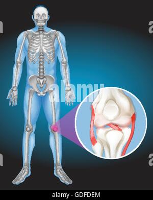 Il corpo umano e il dolore nella illustrazione del ginocchio Illustrazione Vettoriale