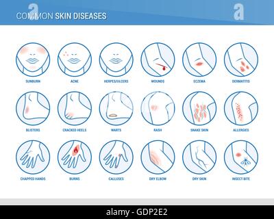 Malattie della pelle set di icone e le parti del corpo, assistenza sanitaria e prevenzione Illustrazione Vettoriale