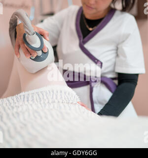 EVLT (trattamento con laser endovenoso) per il trattamento di varici. Foto Stock