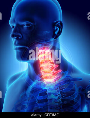 3D'illustrazione, collo doloroso - cervica scheletro della colonna vertebrale x-ray, concetto medico. Foto Stock