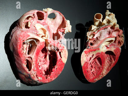 Plastinat, Stark vergroessertes menschliches Herz, il dottor Gunter von Hagens, MeMu, Menschen Museum di Berlino, Deutschland Foto Stock