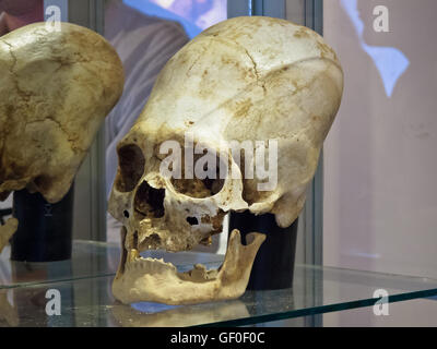 Cranio allungato di antica Paracas mostrato umano a Paracas History Museum Foto Stock