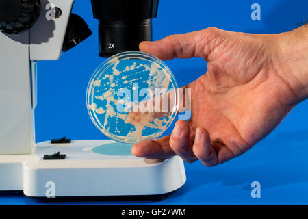 Laboratorio medico mano azienda piastra petri con batteri. Foto Stock