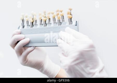 Mano umana tenendo lo sbiancamento dei denti nella clinica del dentista. Foto Stock