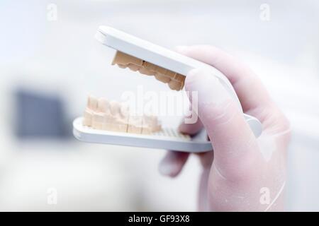 Dentista holding stampo dentali dentista in clinica. Foto Stock