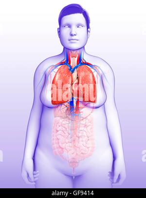 Illustrazione della femmina di insufficienza respiratoria e cardiovascolare. Foto Stock