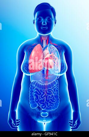 Illustrazione della femmina di insufficienza respiratoria e cardiovascolare. Foto Stock