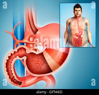 Illustrazione di strati dello stomaco. Foto Stock