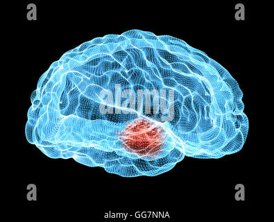 Cervello malattie degenerative, il morbo di Parkinson Foto Stock