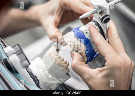 Odontotecnico lavora con dente protesi al laboratorio di protesi Foto Stock