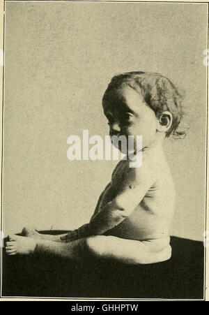 Infant-alimentando nel suo rapporto con la salute e la malattia, da Louis Fischer; contenente 54 illustrazioni, con 24 di grafici e tabelle, gran parte originale (1903) Foto Stock