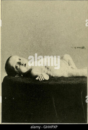 Infant-alimentando nel suo rapporto con la salute e la malattia, da Louis Fischer; contenente 54 illustrazioni, con 24 di grafici e tabelle, gran parte originale (1903) Foto Stock