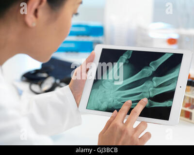 Medico visualizzazione X-ray della mano sulla tavoletta digitale Foto Stock