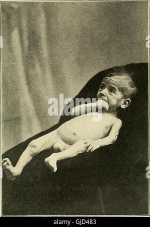 Infant-alimentando nel suo rapporto con la salute e la malattia, da Louis Fischer; contenente 54 illustrazioni, con 24 di grafici e tabelle, gran parte originale (1903) Foto Stock