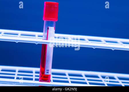 Medical flaconcino con campione di sangue Foto Stock