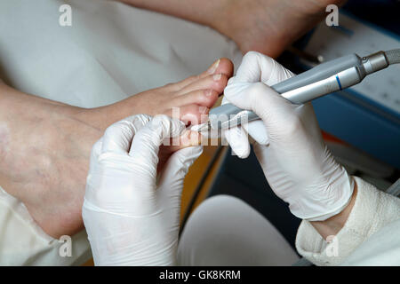 Pedicure medica - cura dei piedi - podologia Foto Stock