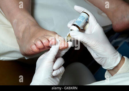 Podologia - cura dei piedi - podologia Foto Stock