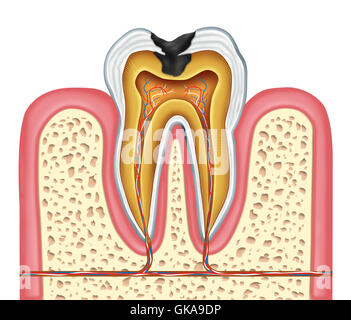 Singola radice dei denti Foto Stock