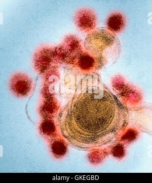 Zika le particelle di virus.colorato micrografia elettronica a trasmissione (TEM) di negativo-colorate Fortaleza-ceppo Zika le particelle di virus Foto Stock