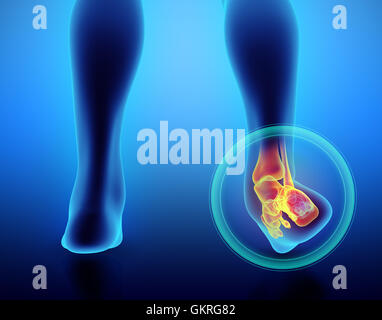 Caviglia doloroso - scheletro x-ray 3D illustrazione concetto medico. Foto Stock