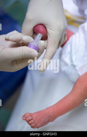 Dresden, Germania. Il 22 agosto, 2016. Un infermiere prende un campione di sangue di un neonato per una fibrosi cistica screening su settimana ward dei figli della donna e del centro dell' ospedale universitario Carl Gustav Carus a Dresda (Germania), 22 agosto 2016. I neonati possono ora essere testati per fibroris cistica su tutto il territorio nazionale. Lo screening per la diagnosi precoce del raro, ereditabile malattia metabolica verrà introdotto il 1 settembre 2016. Foto: Arno Burgi/ZB/dpa/Alamy Live News Foto Stock