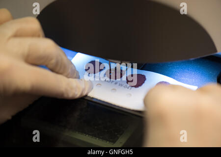 Dresden, Germania. Il 22 agosto, 2016. Un file scheda con il sangue di un neonato è stampato per una fibrosi cistica screening in laboratorio alla settimana ward dei figli della donna e del centro dell' ospedale universitario Carl Gustav Carus a Dresda (Germania), 22 agosto 2016. I neonati possono ora essere testati per fibroris cistica su tutto il territorio nazionale. Lo screening per la diagnosi precoce del raro, ereditabile malattia metabolica verrà introdotto il 1 settembre 2016. Foto: Arno Burgi/ZB/dpa/Alamy Live News Foto Stock