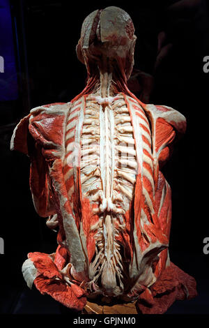 Plastinate, umani indietro, il midollo spinale e il sistema nervoso, corpo mondi, Menschen Museum di Berlino, Germania Foto Stock