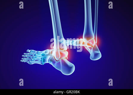 Piede dello scheletro - injuryd osso astragalico. Vista a raggi x. Accurata dal punto di vista medico 3D illustrazione Foto Stock