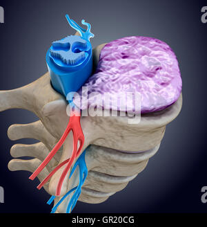 Il midollo spinale sotto pressione di rigonfiamento disco. Accurata dal punto di vista medico 3D illustrazione Foto Stock