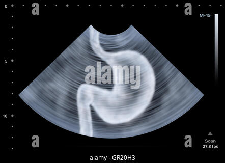 Scansione ad ultrasuoni di stomaco umano. Illustrazione Foto Stock