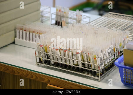 Tubi preparati per macchina centrifuga nel laboratorio di ematologia / tubi di sangue con etichette nel vassoio circolare Foto Stock