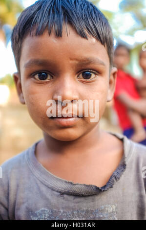 HAMPI, India - 31 gennaio 2015: ragazzo indiano con cicatrice sotto il naso in strada Foto Stock